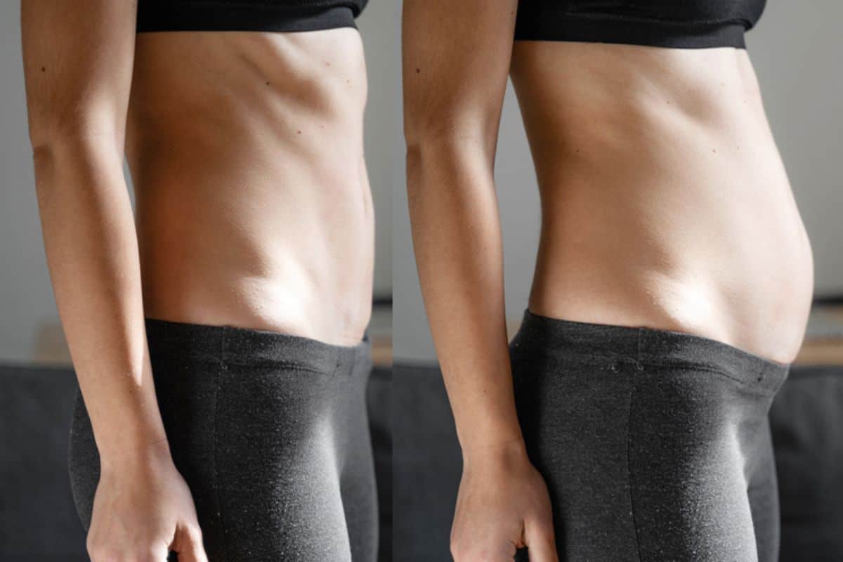 How long does diastasis recti take to improve Enfield Lock?
