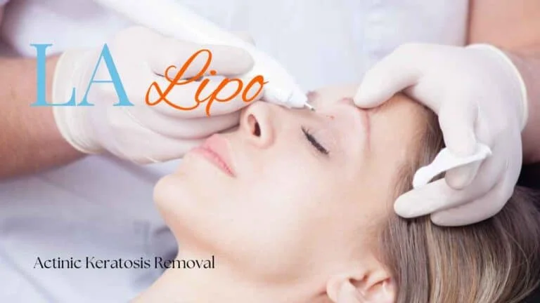 Woman receiving Actinic Keratosis Removal Treatment Enfield Lock