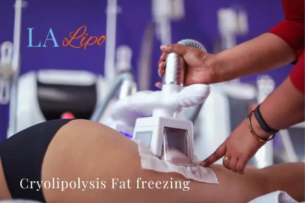 women getting fat freezing Enfield Lock