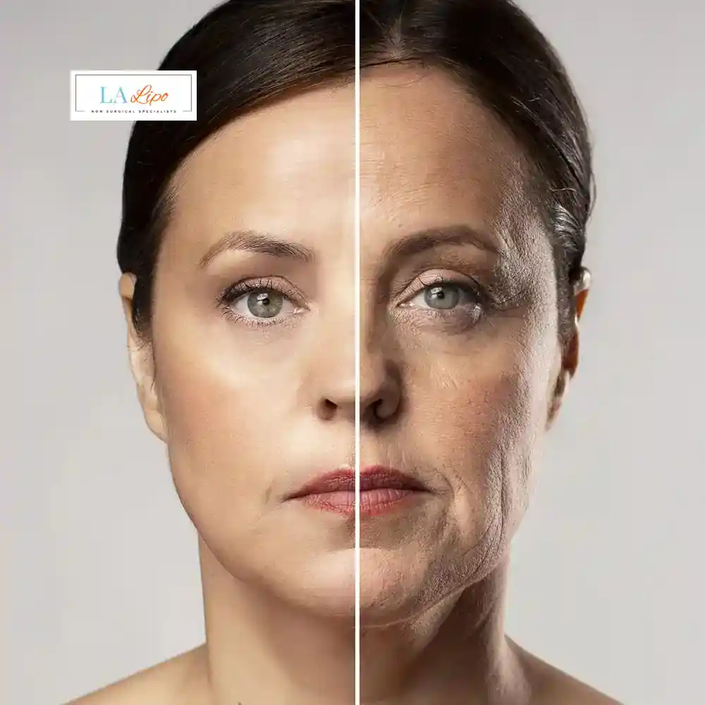 How Can You Tell If Non-Surgical Skin Tightening Is Right for You Enfield Lock?