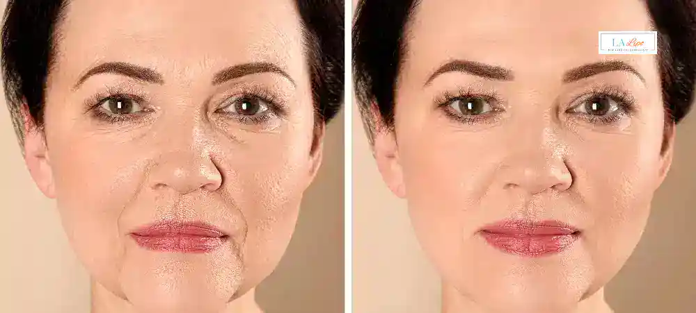 Why Aren’t My Skincare Products Making My Sagging Skin Look Firmer Enfield Lock?