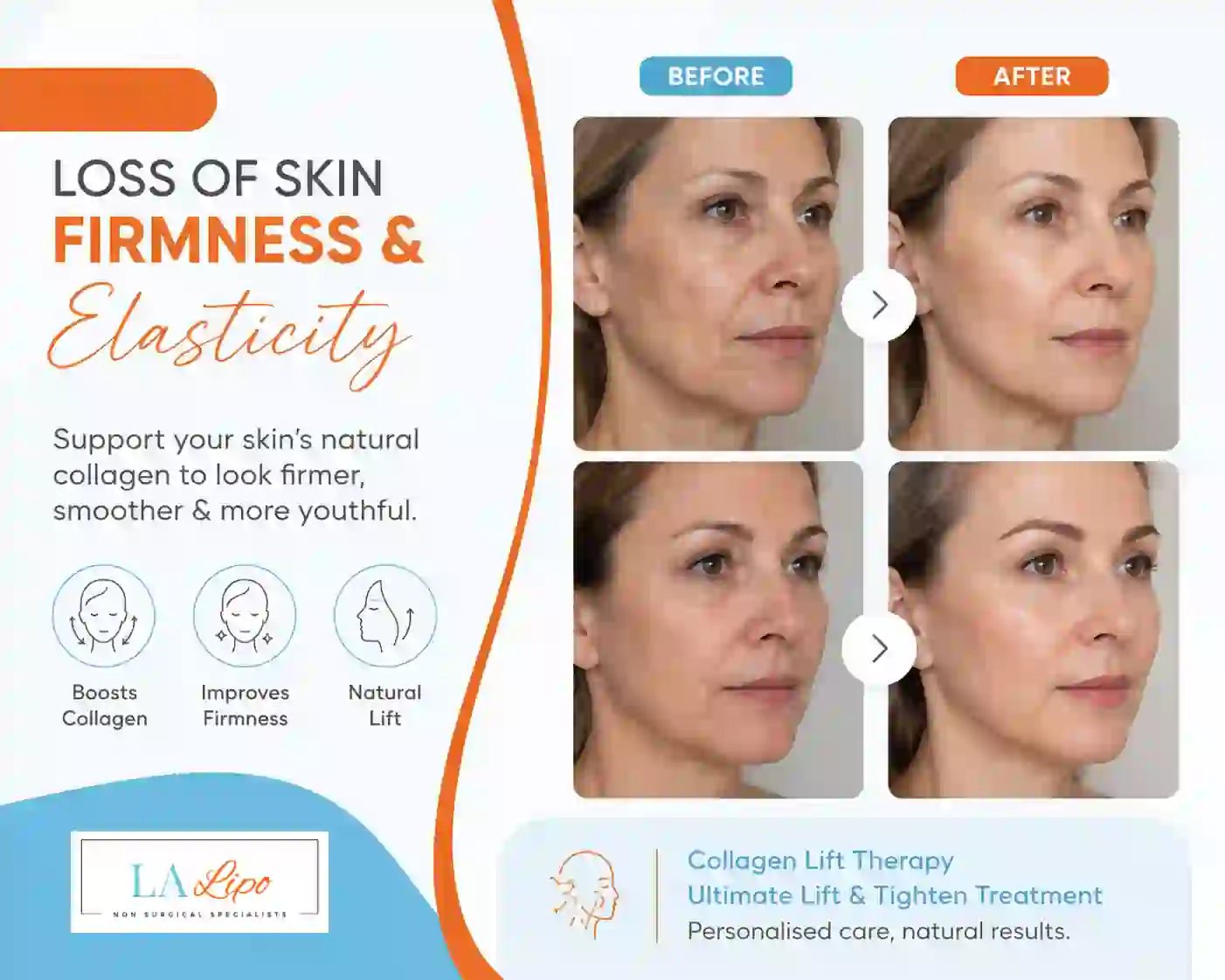 Sign #7: Loss of Skin Firmness and Elasticity Enfield Lock
