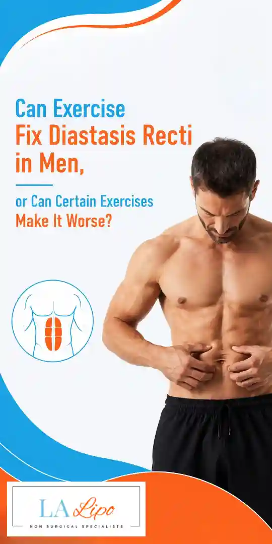 Can Exercise Fix Diastasis Recti in Men, or Can Certain Exercises Make It Worse Enfield Lock?
